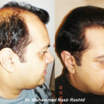 61-dr.-nasir-mughal-02