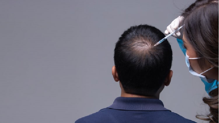 Hair Transplant Surgery