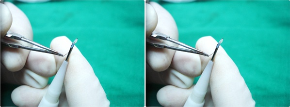 auto-inject